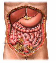 abdominal cavity