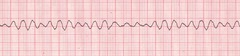 EMS personnel arrive to find a patient in cardiac arrest. Bystanders are performing CPR. After attaching a cardiac monitor, the responder observes the following rhythm strip. What is the most important early intervention?