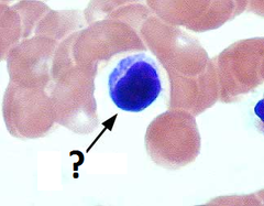 lymphocytes