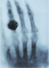 Rontgen
FRAU RONTGEN'S HAND
1895