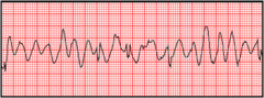 You are monitoring a patient with chest discomfort who suddenly becomes unresponsive. You observe the following rhythm on the cardiac monitor. A defibrillator is present. What is your first action?