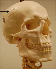 Parietal bone