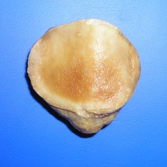 Patella