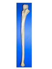 Ulna